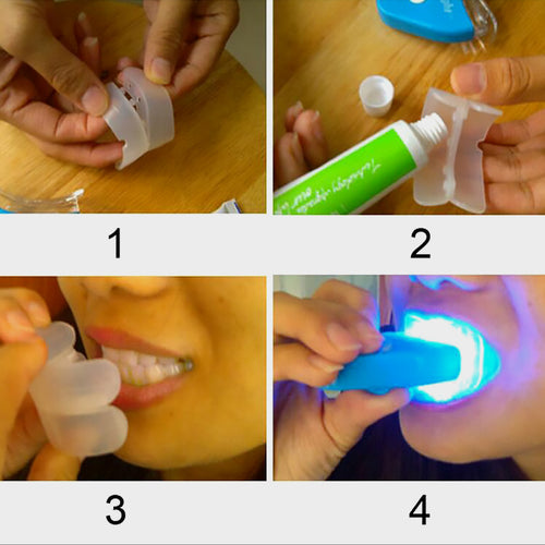 Advanced Professional Teeth Whitening Kit – LED Blue Light Dental Bleaching System