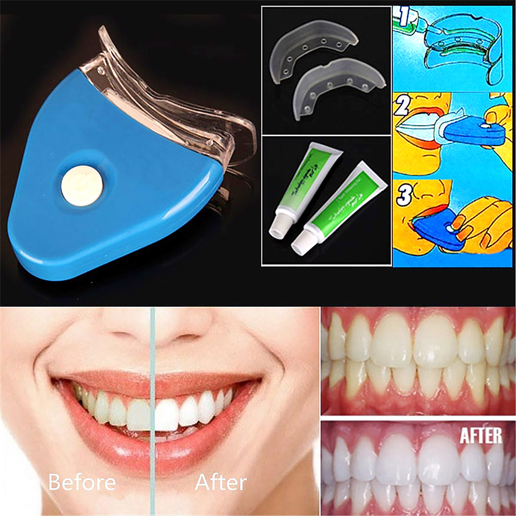 Advanced Professional Teeth Whitening Kit – LED Blue Light Dental Bleaching System